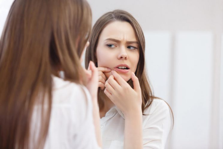 Woman squeezing pimple